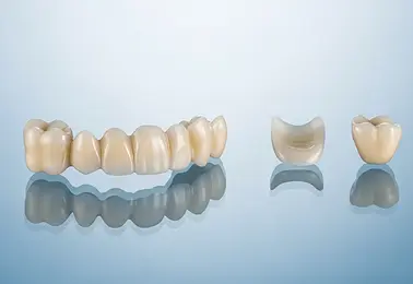 Mehrgliedrige Keramikbr&uuml;cke in Produktansicht